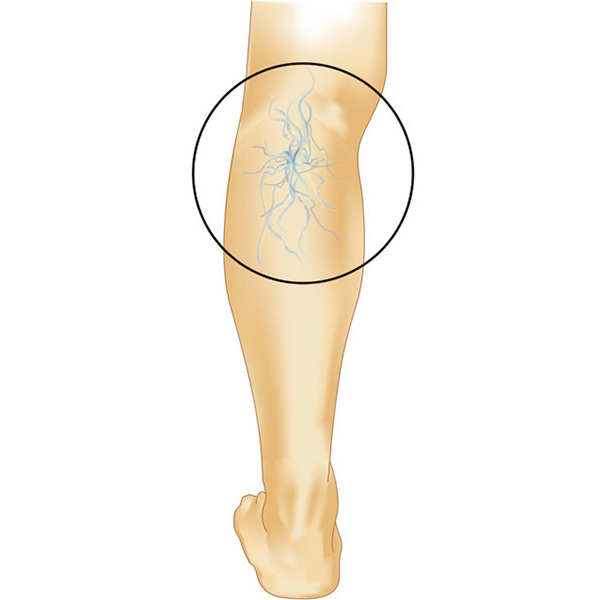足 の 血管 目立つ
